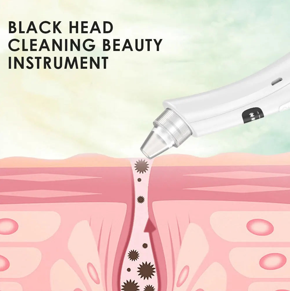 Aspirateur Points Noirs Électrique– Nettoyeur de Pores 3 Modes avec Embouts