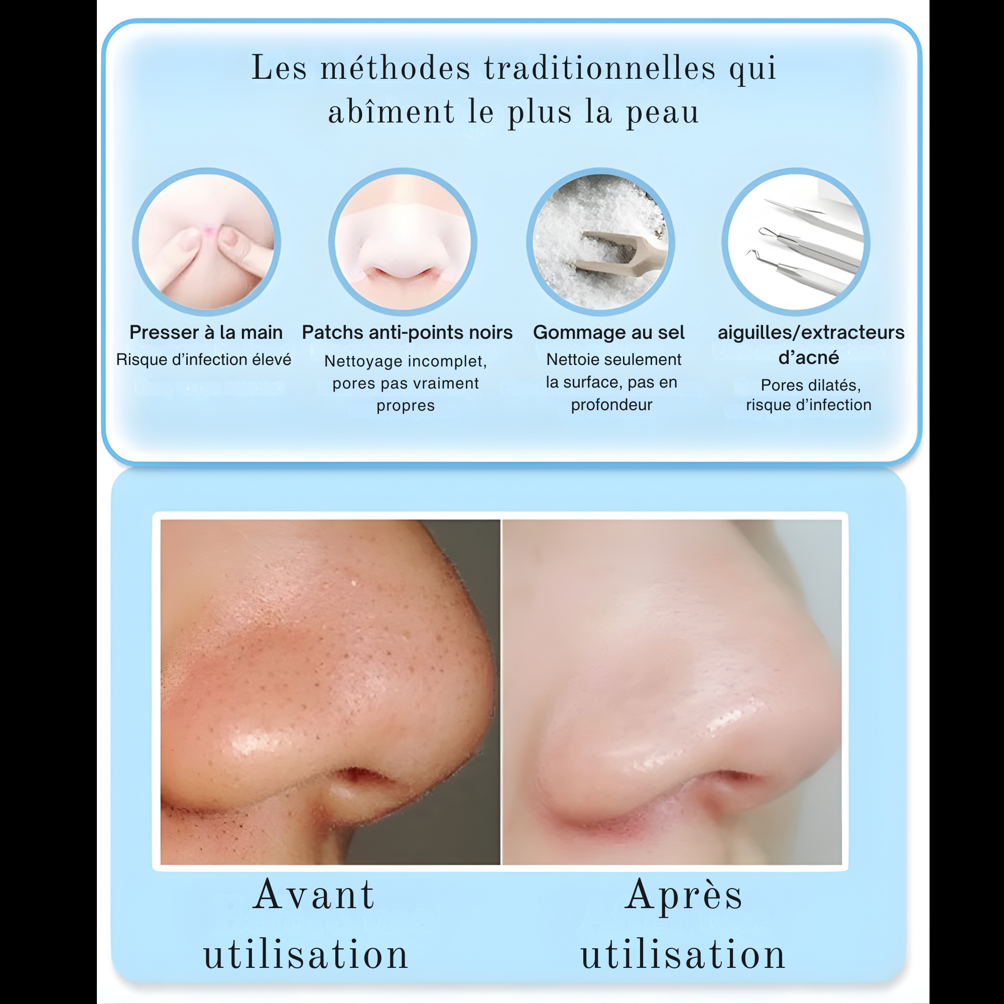 Aspirateur Points Noirs Électrique– Nettoyeur de Pores 3 Modes avec Embouts