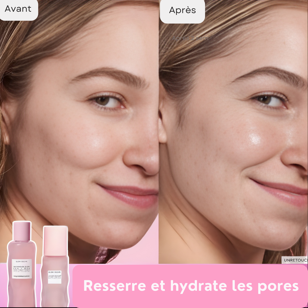 Watermelon Glow PHA+BHA