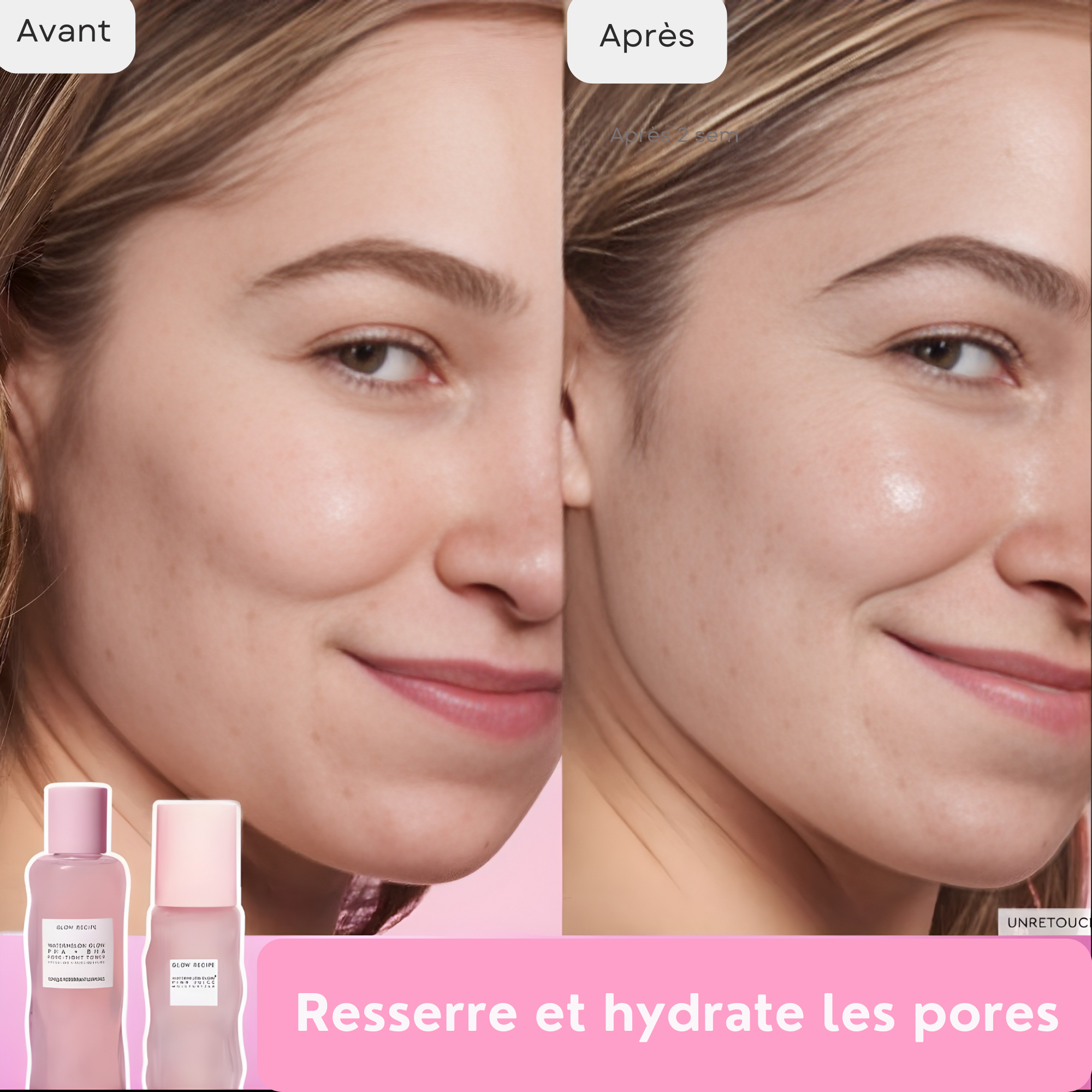 Watermelon Glow PHA+BHA