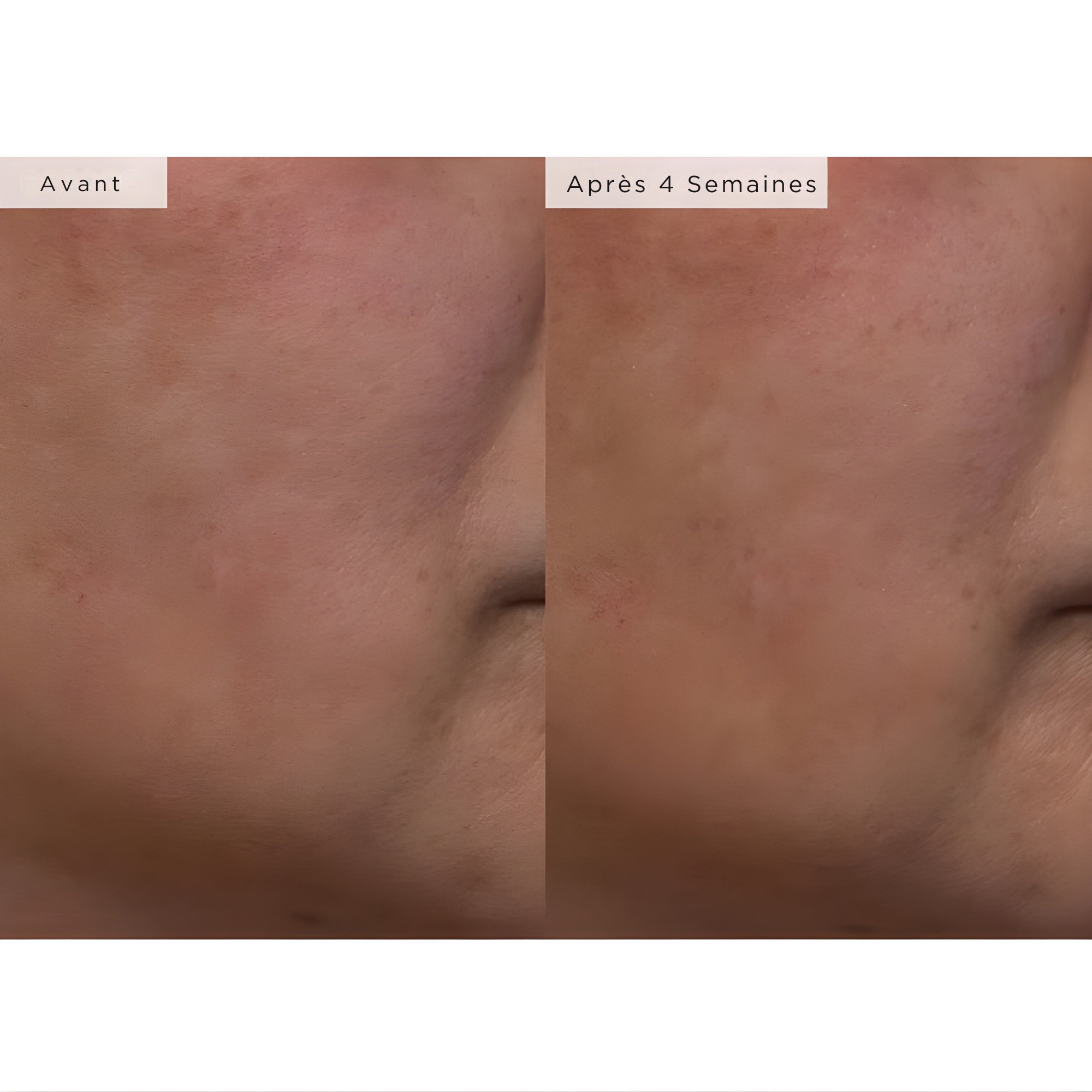 Watermelon Glow PHA+BHA