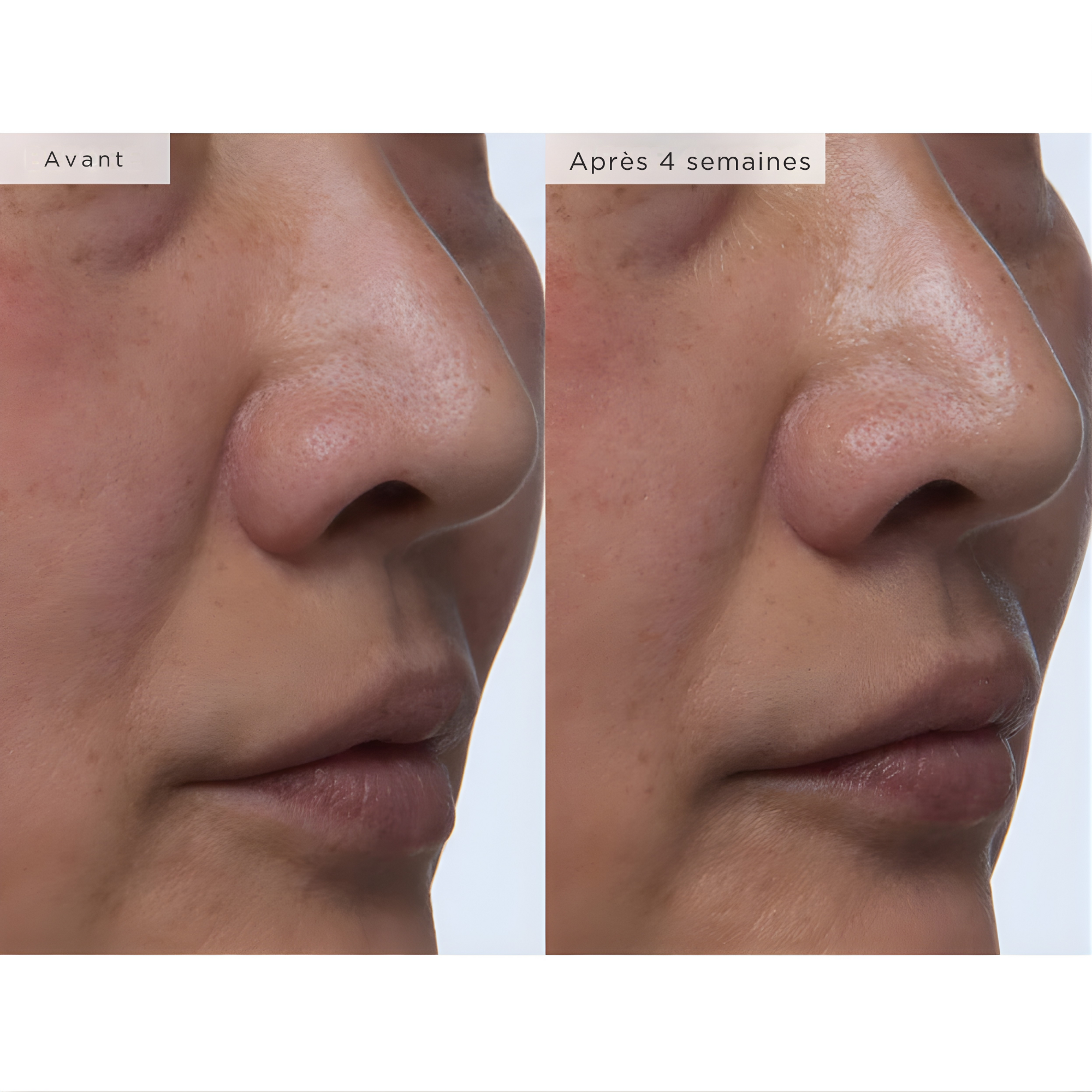 Watermelon Glow PHA+BHA